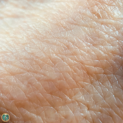 Tackling the look of loose, crepey skin with microneedling and salmon DNA