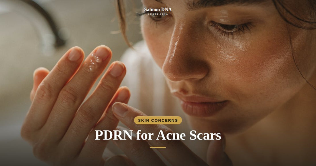 PDRN for acne scars, Salmon DNA Australia