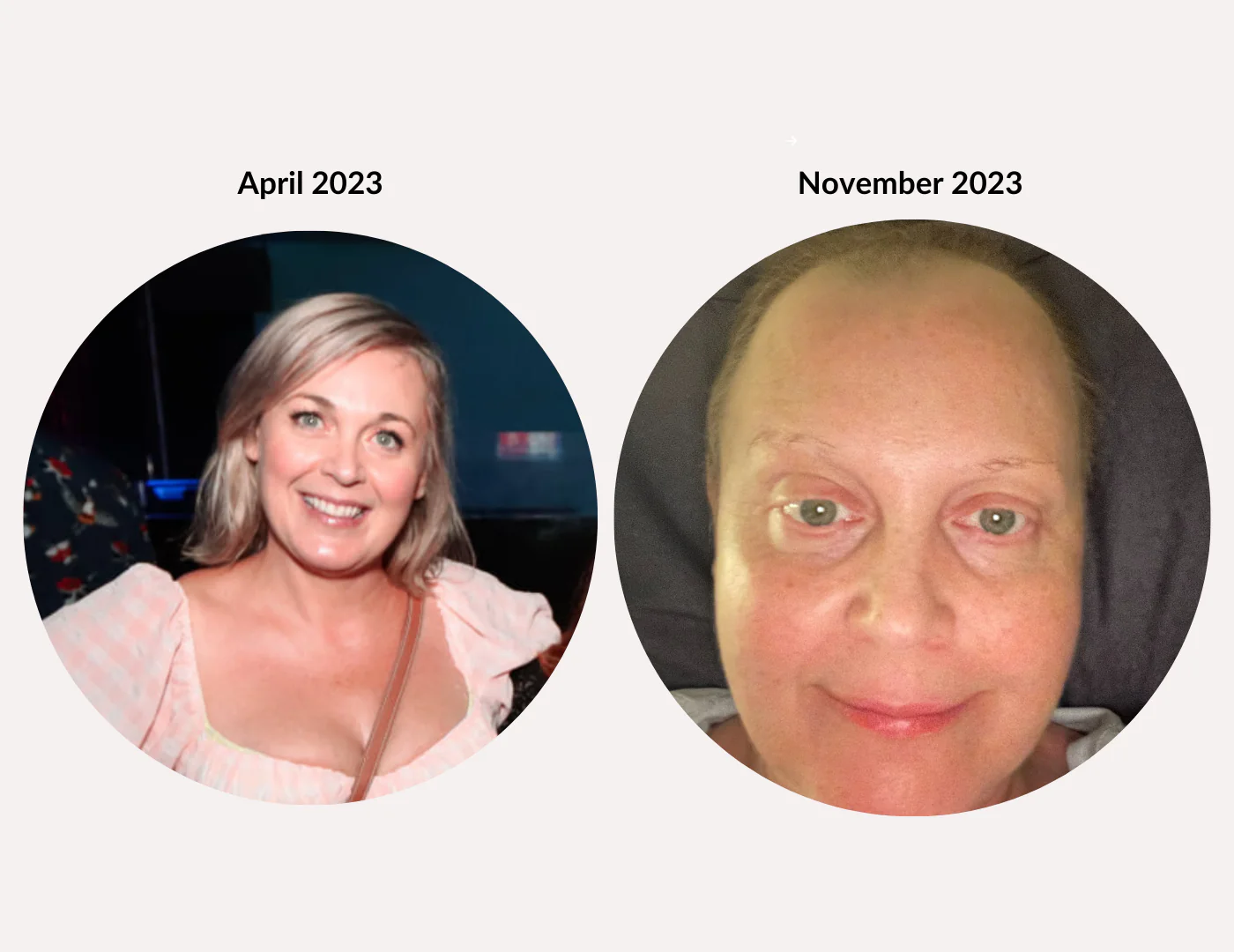 Salmon DNA Australia