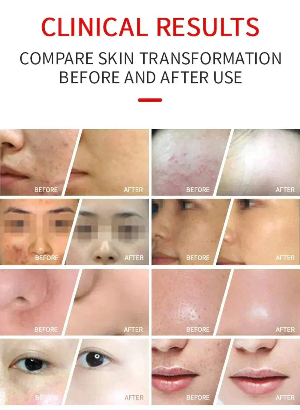 Before and after photos showing skin transformation with the Dual Red Light Mask therapy.